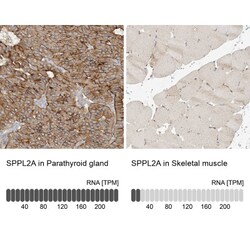 SPPL2a Antibody, Novus Biologicals 0.1mL; Unlabeled:Antibodies, Polyclonal